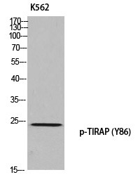 Anti-Phospho-TIRAP (Tyr86) Polyclonal Antibody