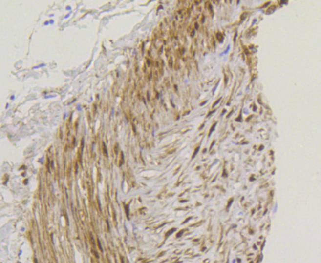 Anti-YAP1 Antibody (7R366)