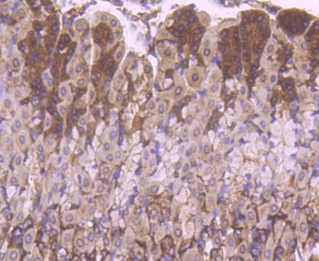 Anti-YB1 Antibody (1K676)
