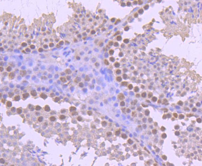Anti-YY1 Antibody (5H894)