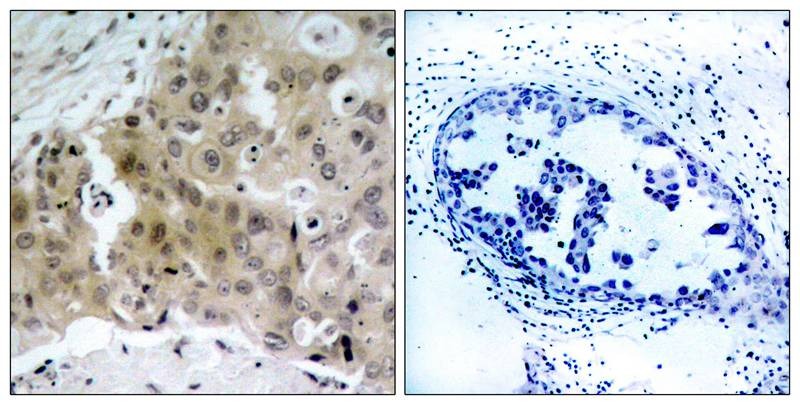 Anti-Phospho-VEGFR2/KDR (Tyr1175) Polyclonal Antibody 3