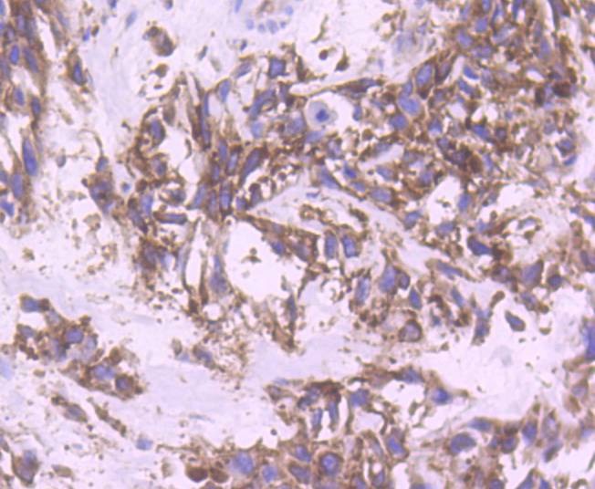 Anti-YB1 Antibody (1K676)
