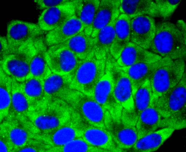 Anti-YB1 Antibody (1K676)
