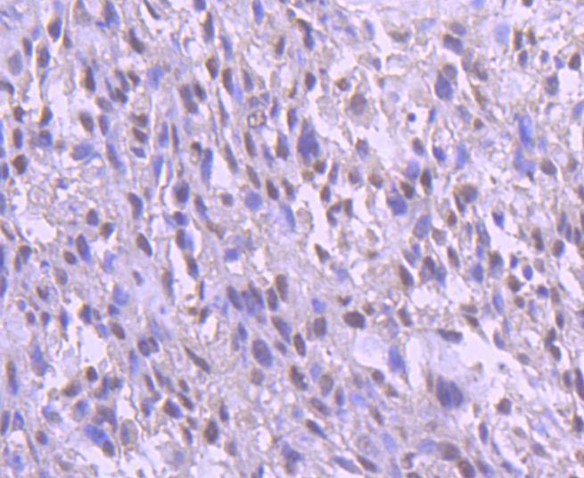 Anti-YY1 Antibody (5H894)