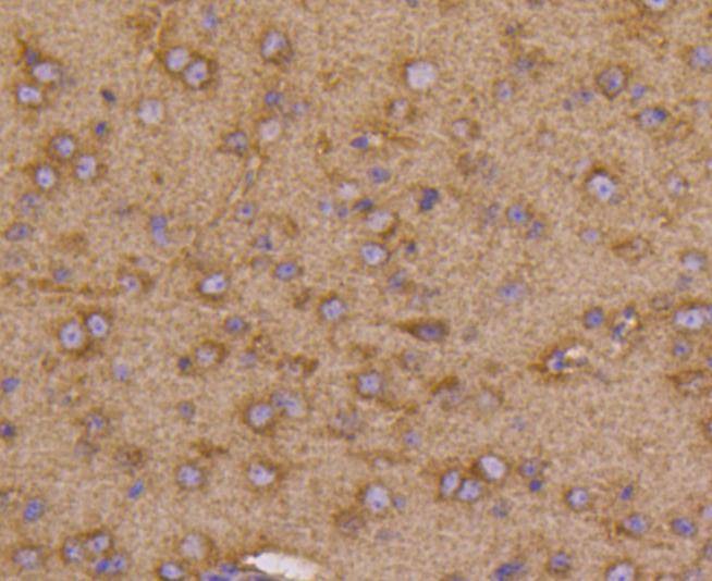 Anti-FLT1 Antibody (9B367)