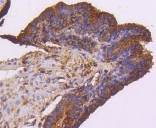 Anti-FLT1 Antibody (9B367)