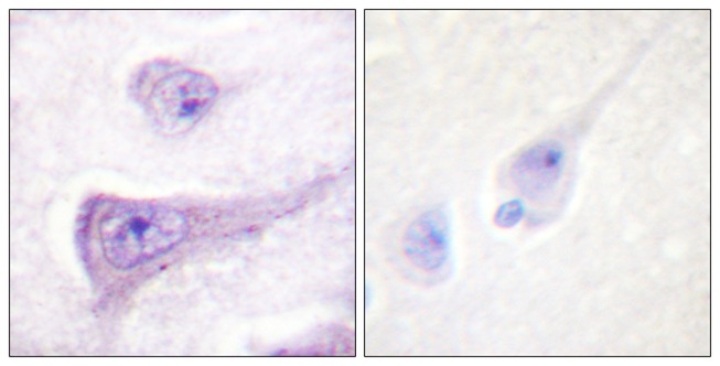 Anti-Phospho-WASP (Tyr290) Polyclonal Antibody