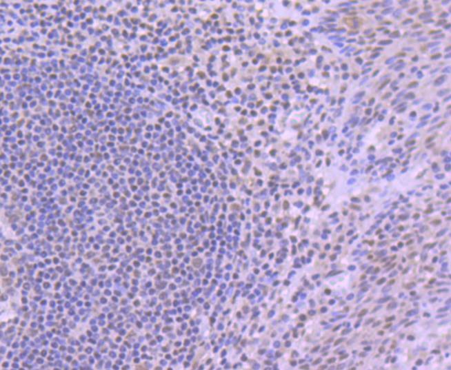 Anti-YY1 Antibody (5H894)