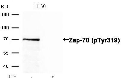 Anti-Phospho-ZAP70 (Tyr319) Polyclonal Antibody