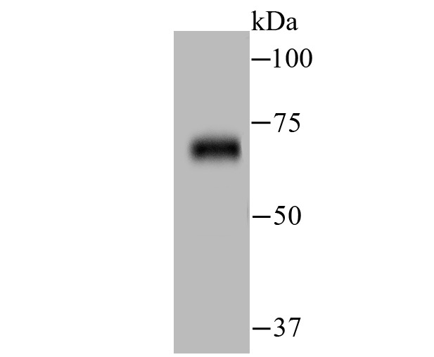 Anti-ZAP70 Antibody (2J161)