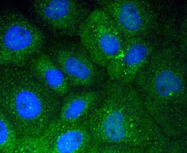 Anti-Vitronectin Antibody (8C403)