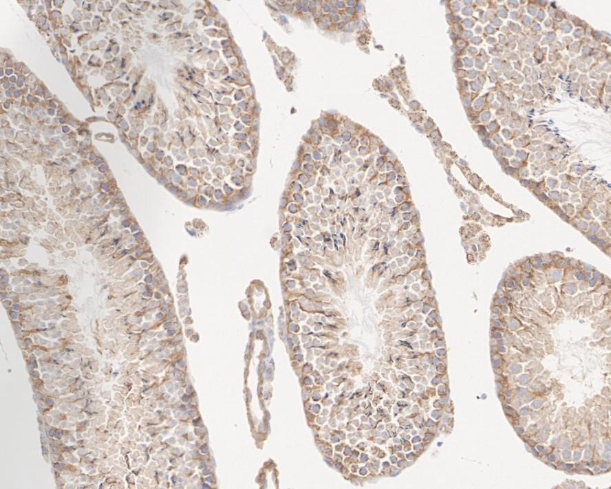 Anti-Vinculin Antibody (3Q495)