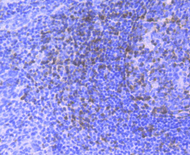 Anti-ZAP70 Antibody (2J161)