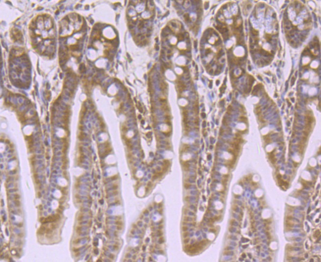 Anti-VPS35 Antibody (7F247)