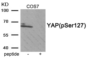 Anti-Phospho-YAP1 (Ser127) Polyclonal Antibody 2