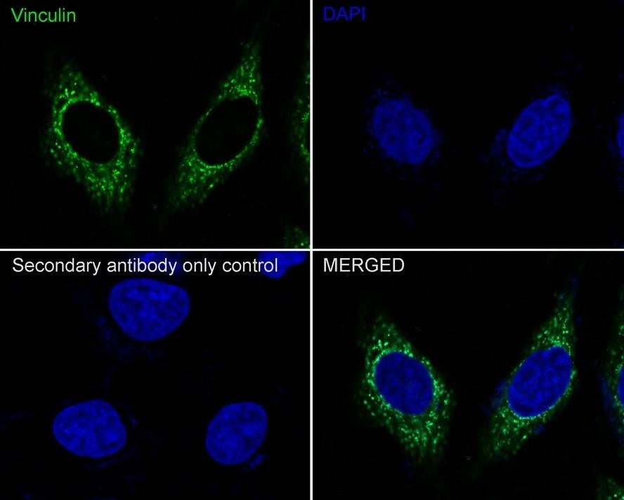 Anti-Vinculin Antibody (3Q495)