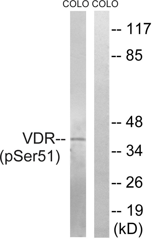 Anti-Phospho-Vitamin D Receptor/VDR (Tyr822) Polyclonal Antibody
