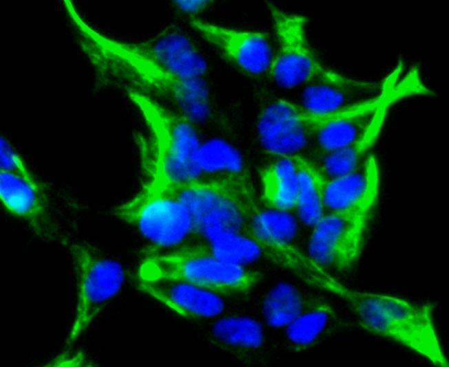 Anti-Vimentin Antibody (3N67)