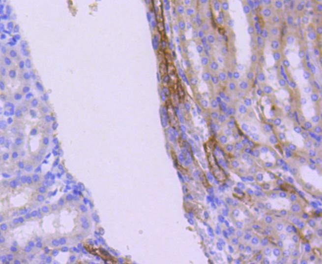 Anti-WASF2 Antibody (1E220)