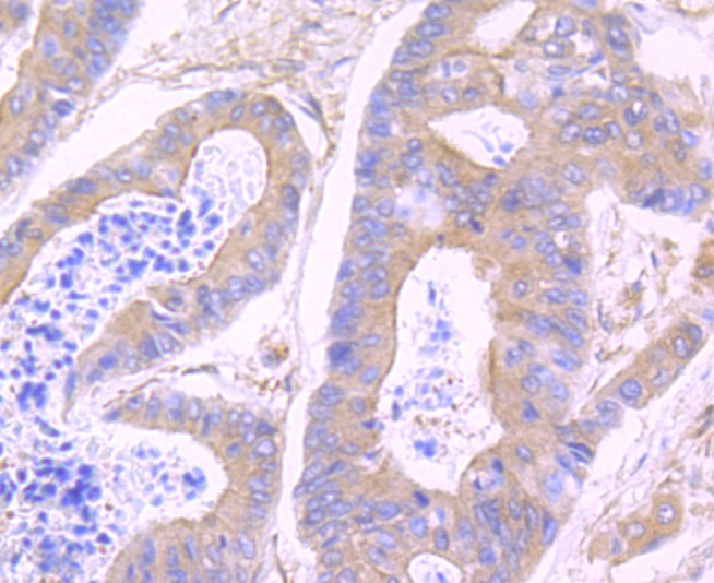 Anti-WASL Antibody (8M531)