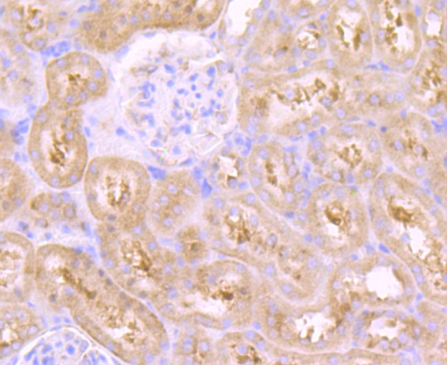 Anti-VPS26 Antibody (5Y706)