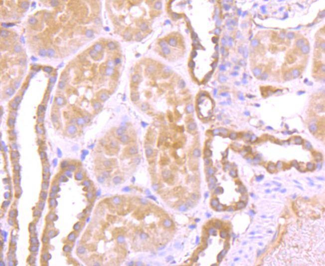 Anti-VDB Antibody (2T657)