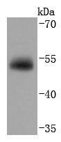 Anti-VDB Antibody (2T657)