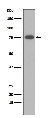 Anti-Vitronectin Antibody (8C403)