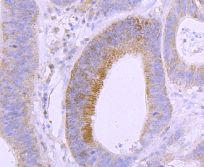 Anti-Vitamin D Receptor/VDR Antibody (5D259)