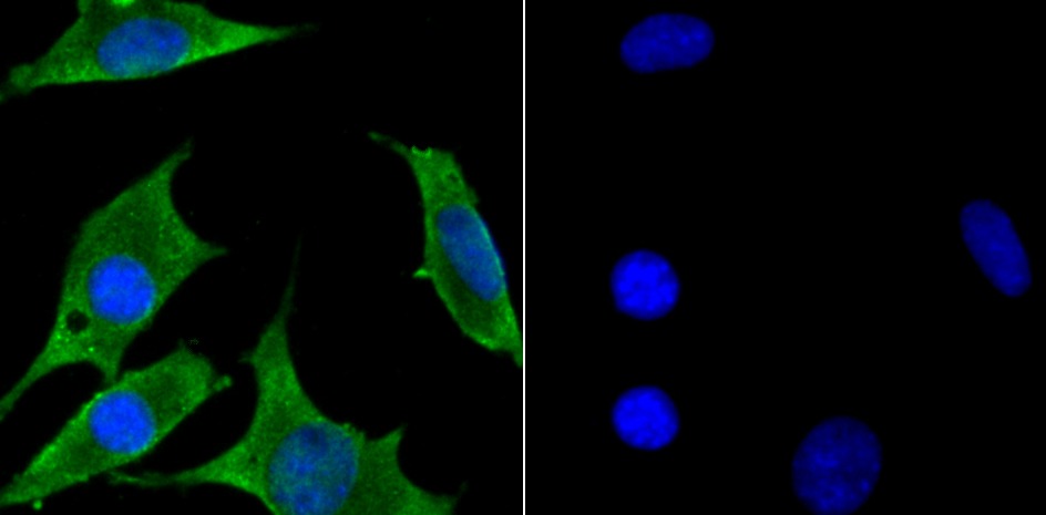 Anti-ZAP70 Antibody (2J161)