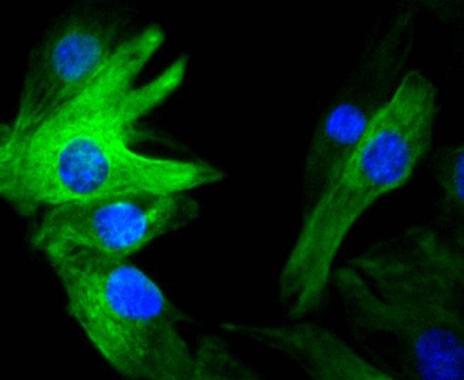 Anti-Vimentin Antibody (3N67)