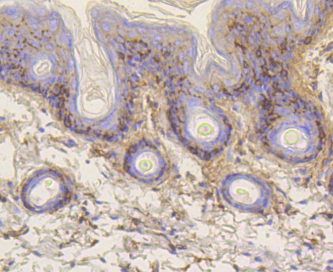 Anti-Vitronectin Antibody (8C403)