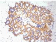 Anti-Beta-Actin Antibody (5H32)