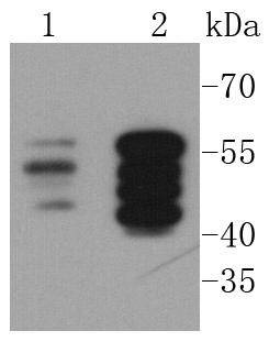 Anti-Vimentin Antibody (3N67)