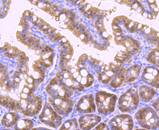 Anti-Vitamin D Receptor/VDR Antibody (5D259)