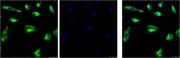 Anti-Vimentin Antibody (8F300)