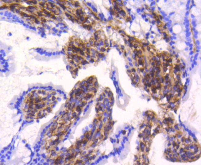 Anti-Vimentin Antibody (3N67)