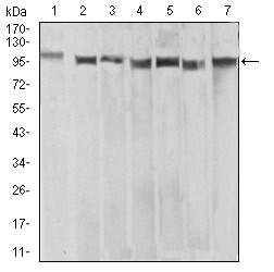 Anti-XRN2 Antibody (1B629)