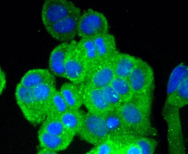 Anti-Vitronectin Antibody (8C403)