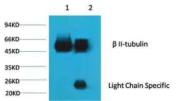 Anti-TUBB2A Antibody (5L160)