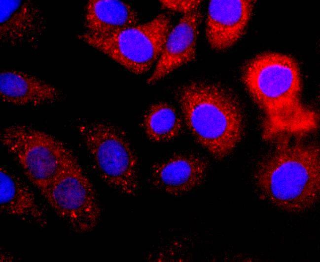 Anti-VDB Antibody (2T657)