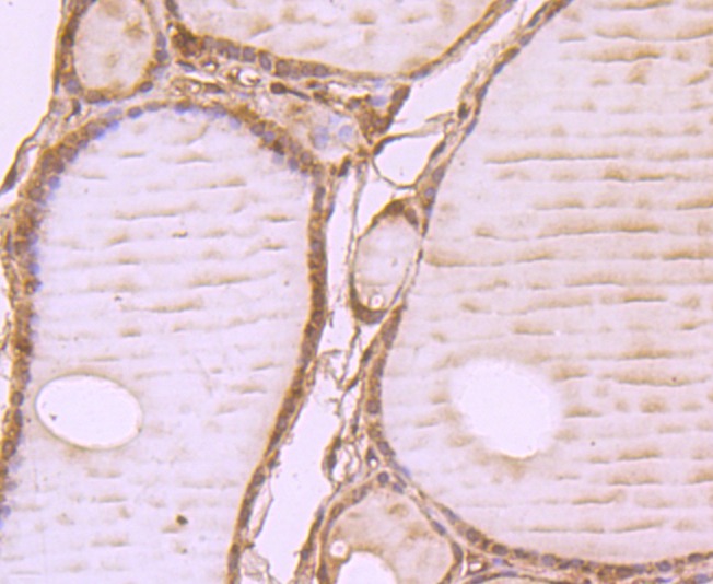 Anti-WSCD2 Antibody (7M244)