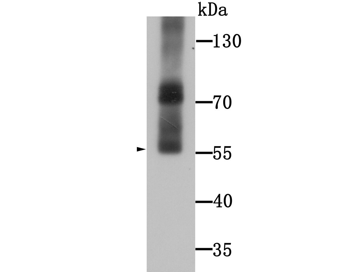 Anti-WSCD2 Antibody (7M244)
