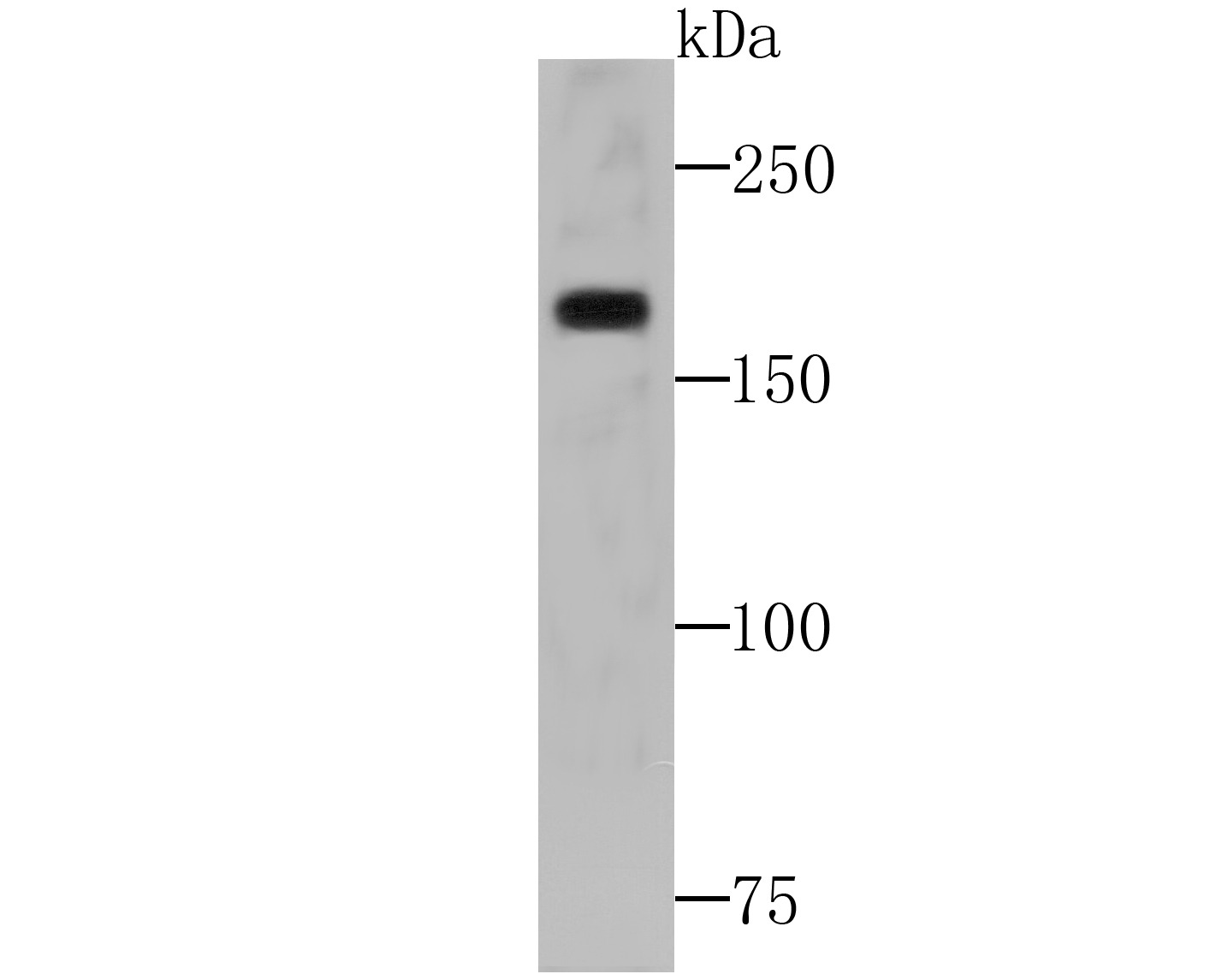 Anti-WSTF Antibody (7C137)
