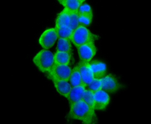 Anti-VAMP1 Antibody (9I639)