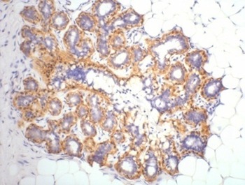 Anti-Beta-Actin Antibody (2J441)