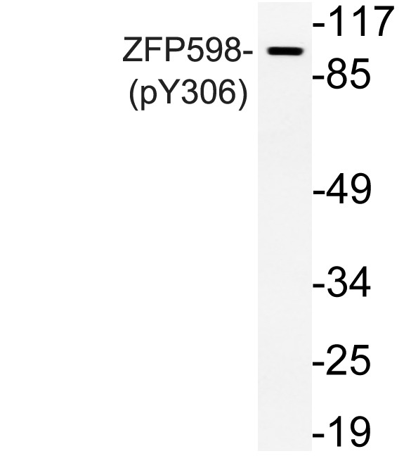 Anti-Phospho-ZFP598 (Tyr306) Polyclonal Antibody