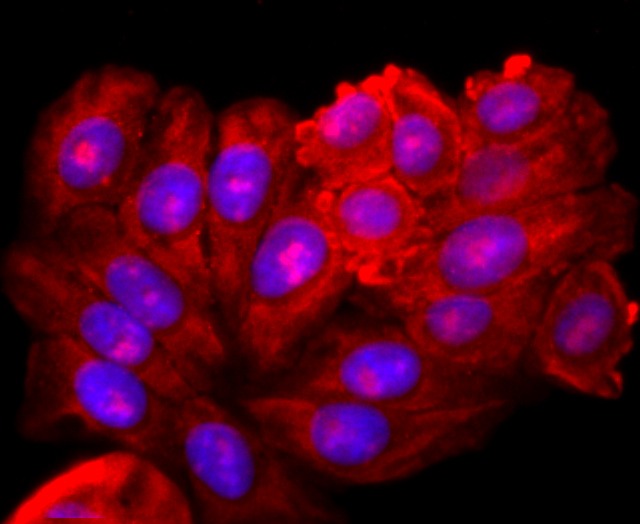 Anti-XBP1 Antibody (8M292)