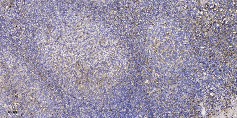 Anti-Phospho-ZFP598 (Tyr306) Polyclonal Antibody