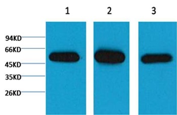 Anti-TUBB1 Antibody (2B743)
